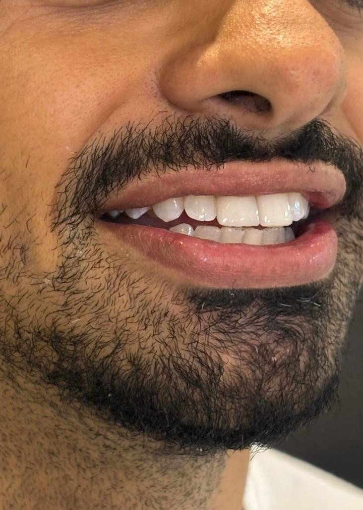 Sorriso após tratamento odontológico